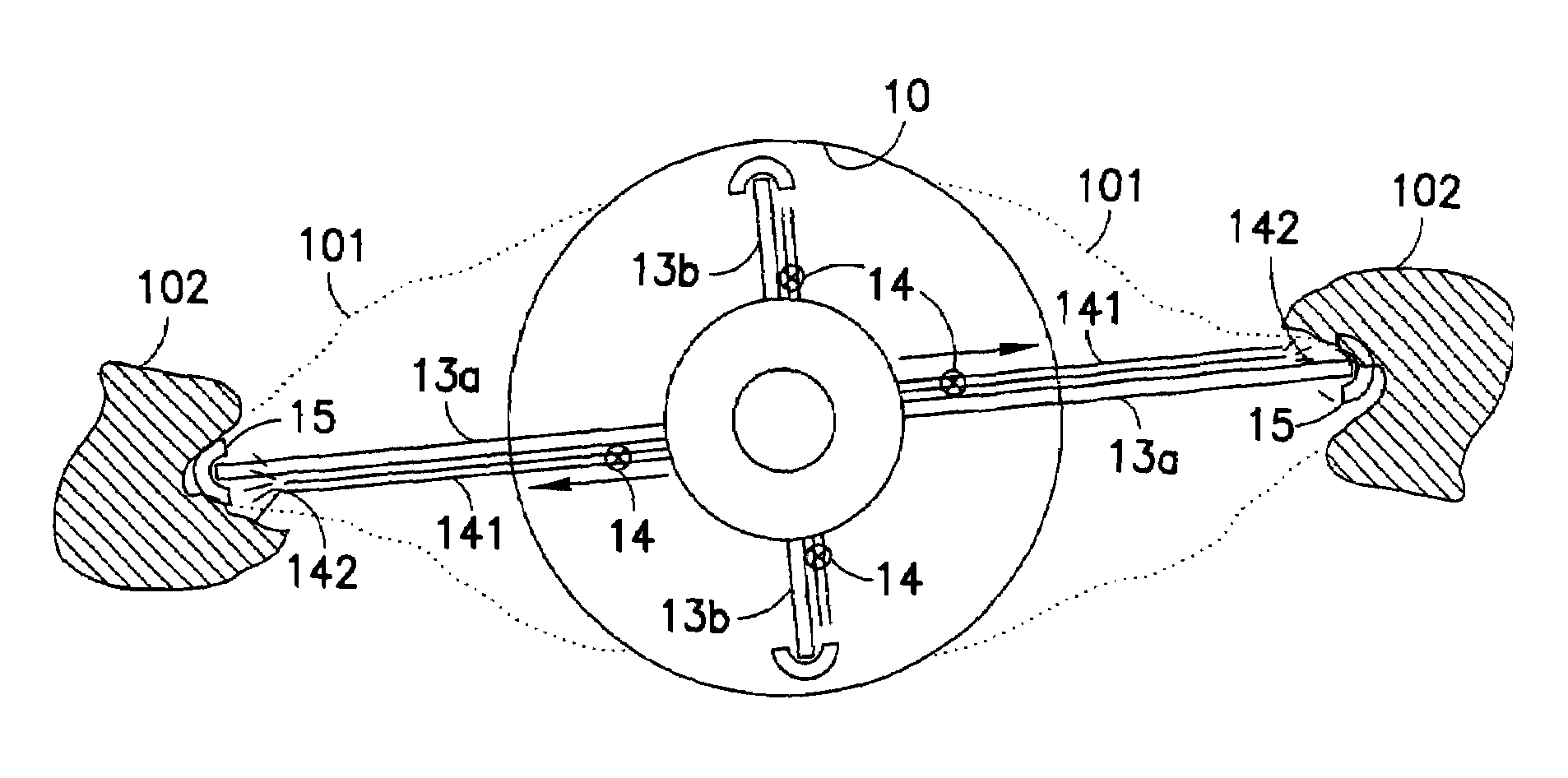 Wellbore treatment apparatus and method