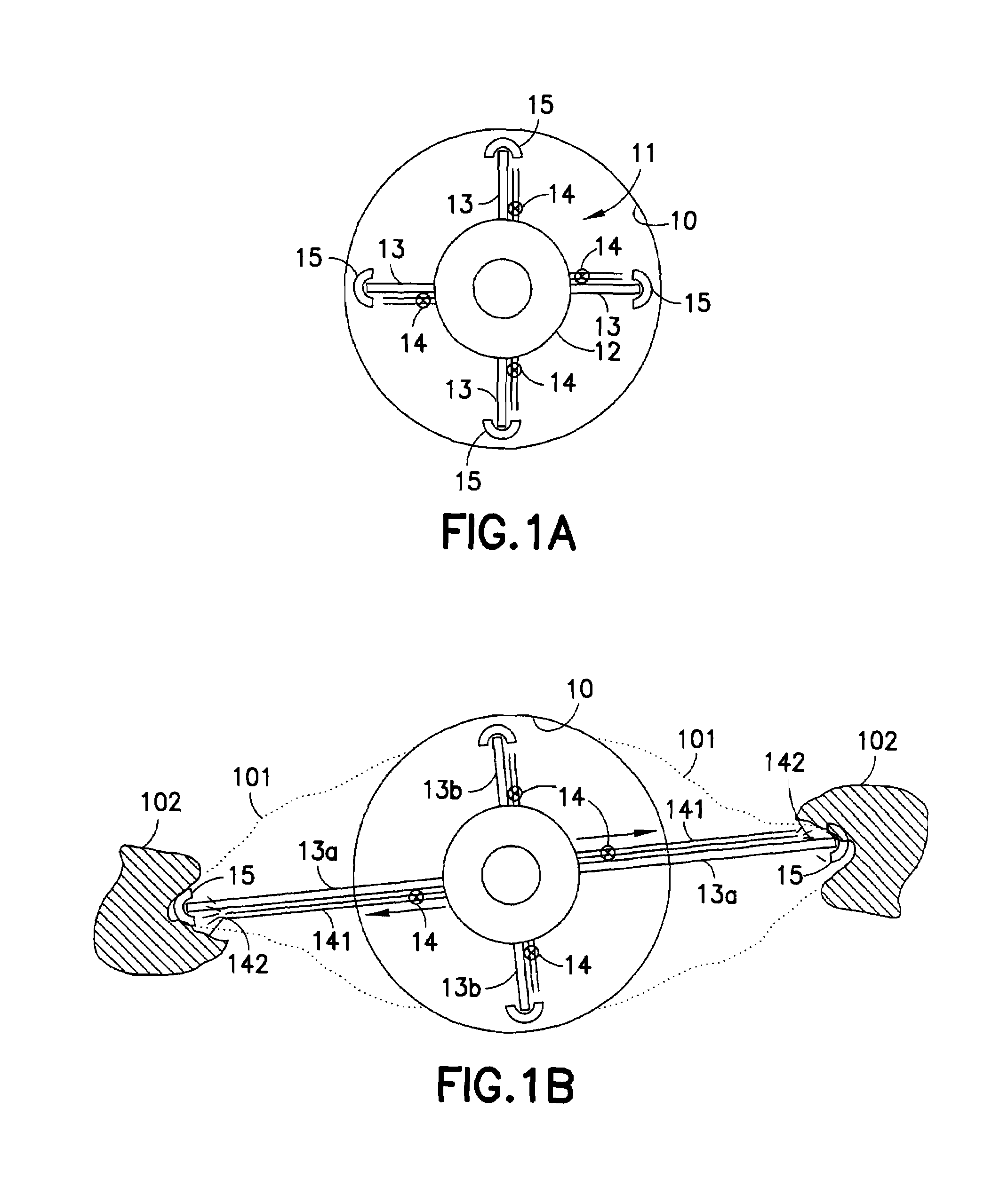 Wellbore treatment apparatus and method