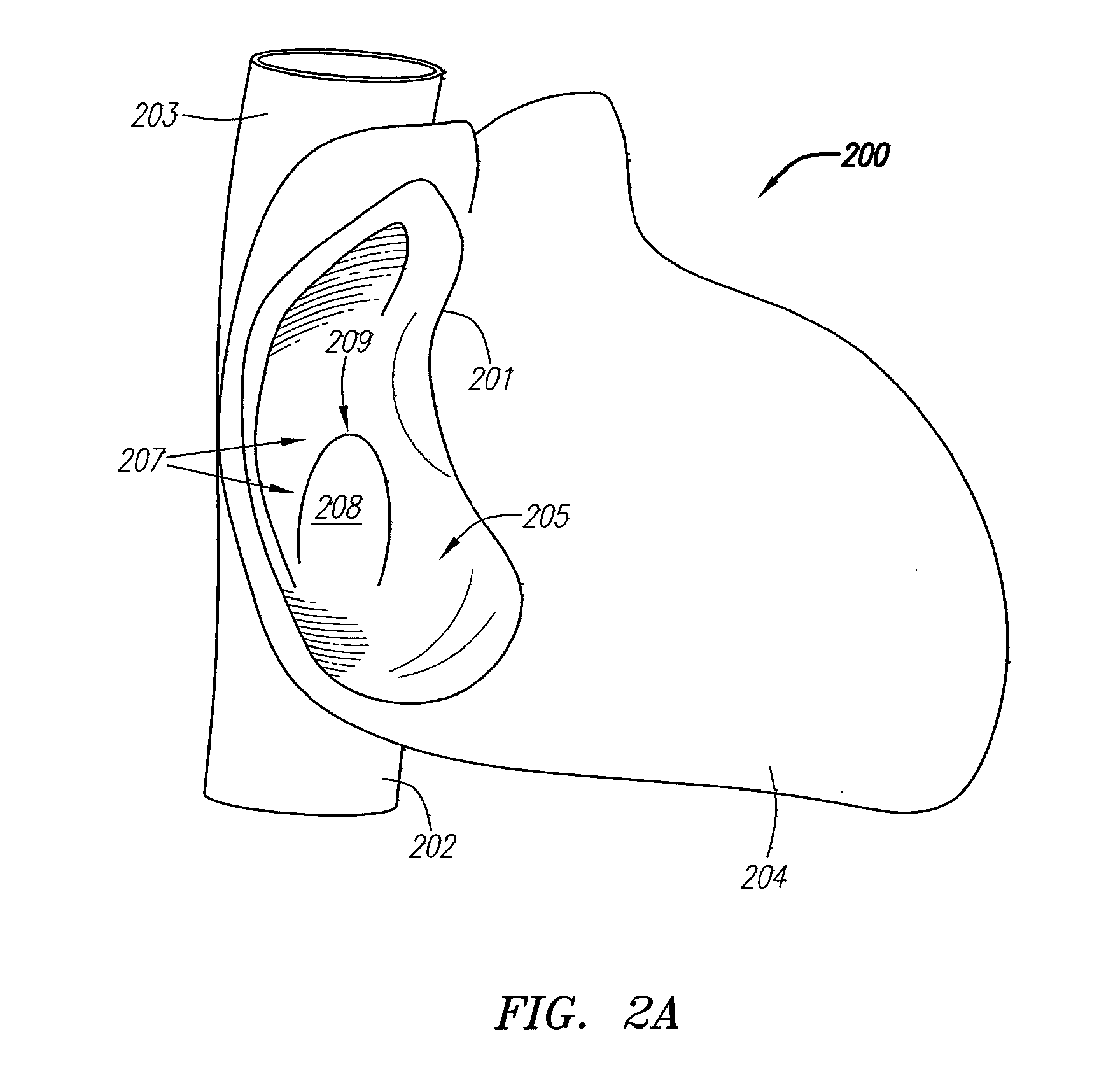 Clip-based systems and methods for treating septal defects