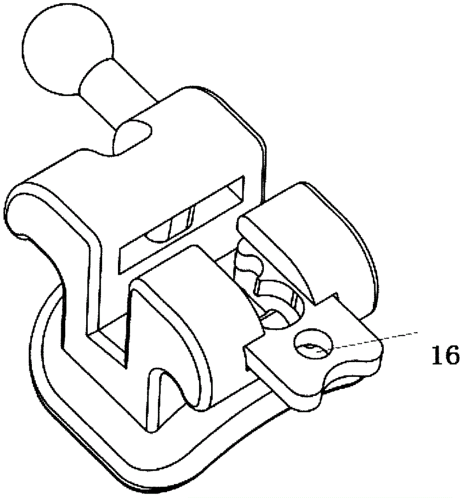 Orthodontic self-ligating bracket