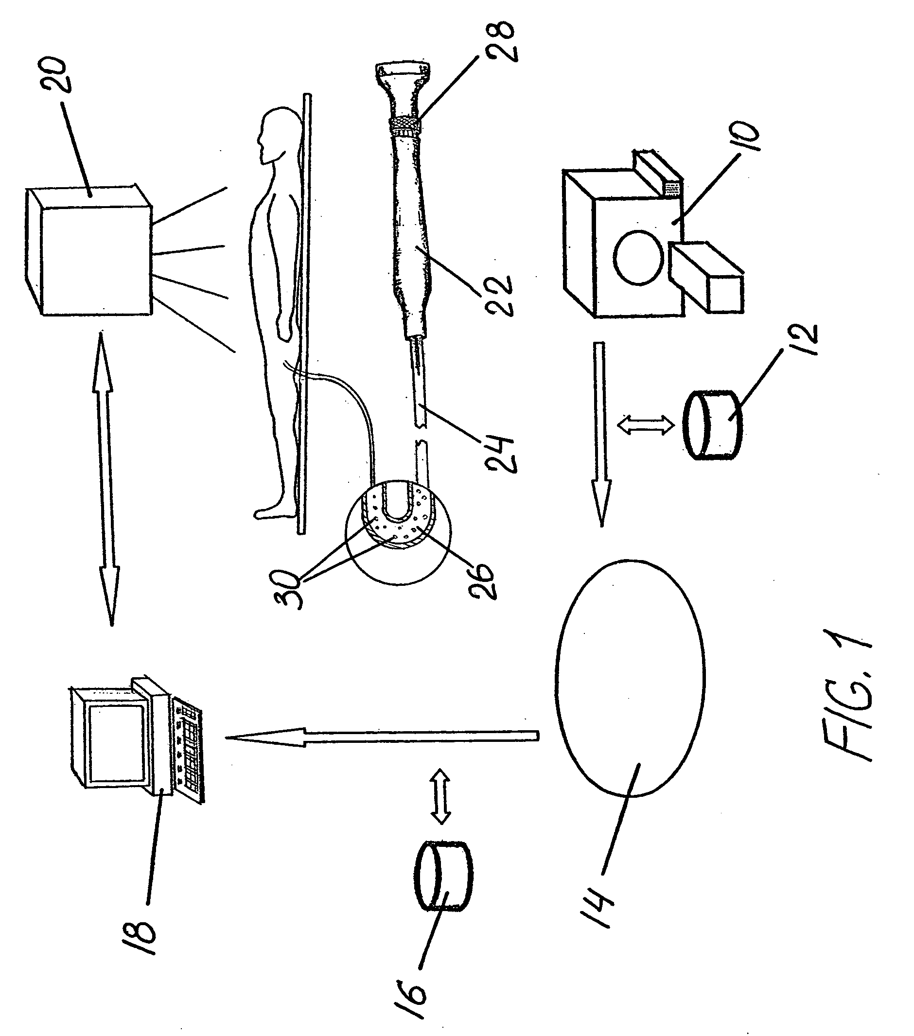 Method and system for treatment of atrial fibrillation and other cardiac arrhythmias