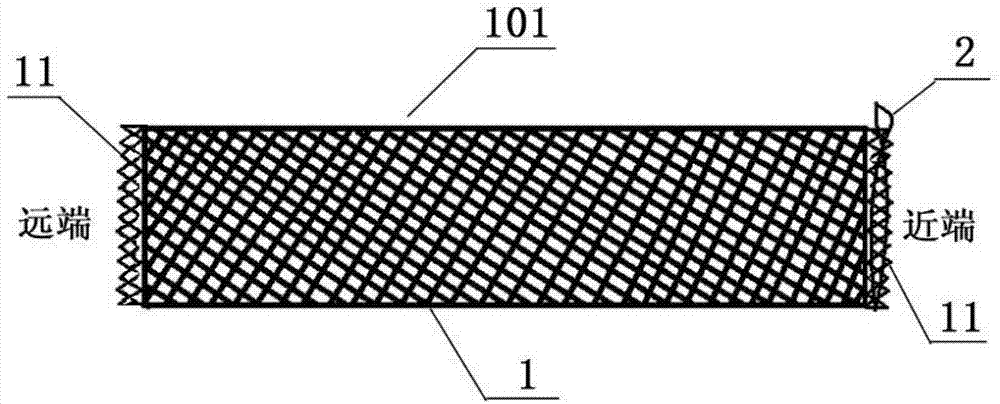 Loop-type temporary cerebrovascular stent