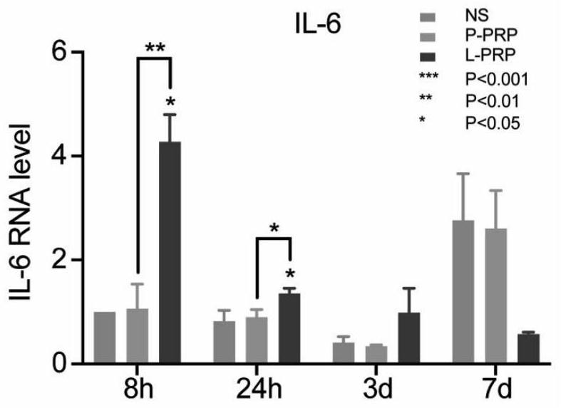 Preparation method of leukocyte-rich and platelet-rich plasma