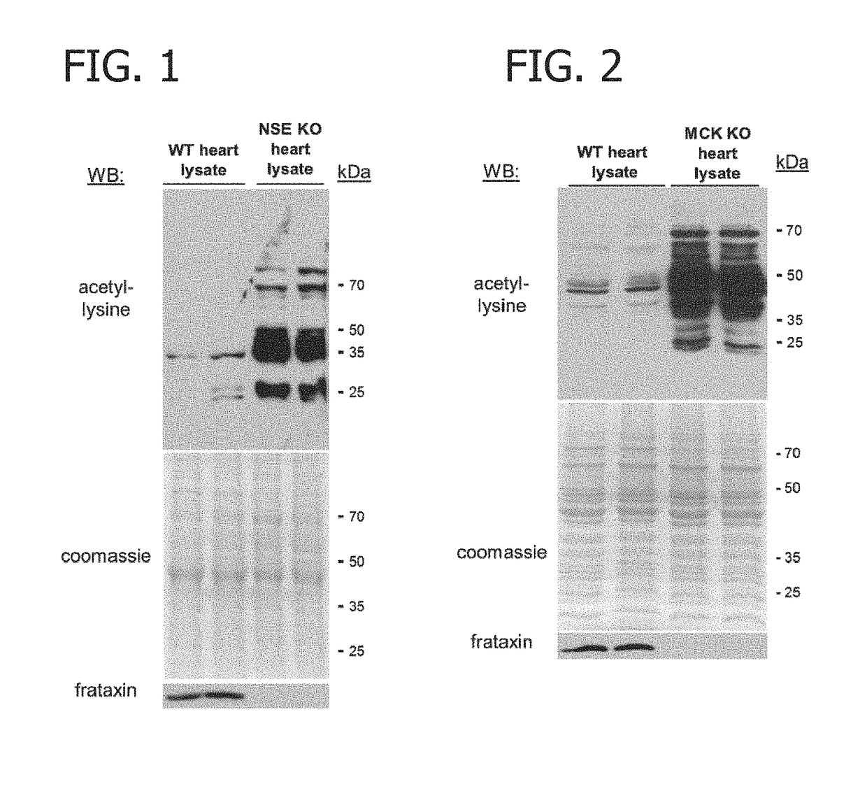 Biomarker for determining mitochondrial damage in friedreich's ataxia