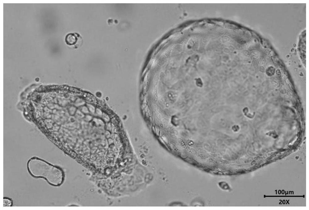 Mouse liver organoid model, establishing method therefor and application of mouse liver organoid model