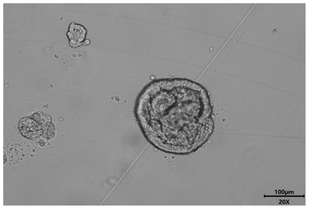 Mouse liver organoid model, establishing method therefor and application of mouse liver organoid model