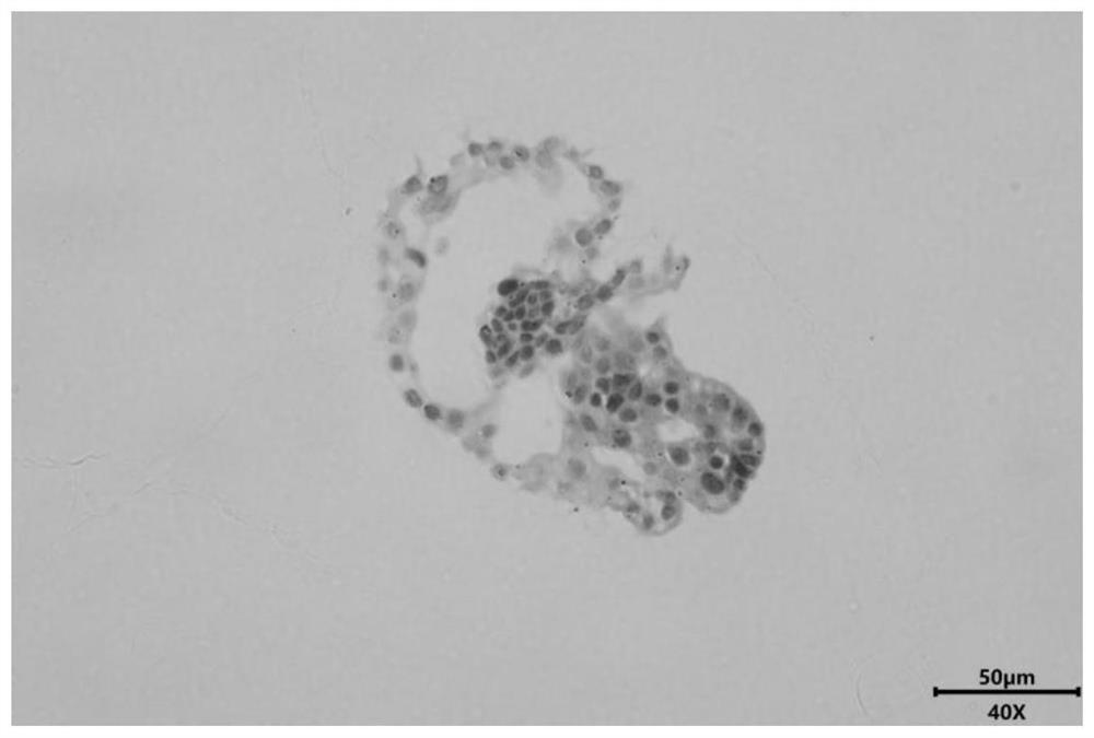 Mouse liver organoid model, establishing method therefor and application of mouse liver organoid model