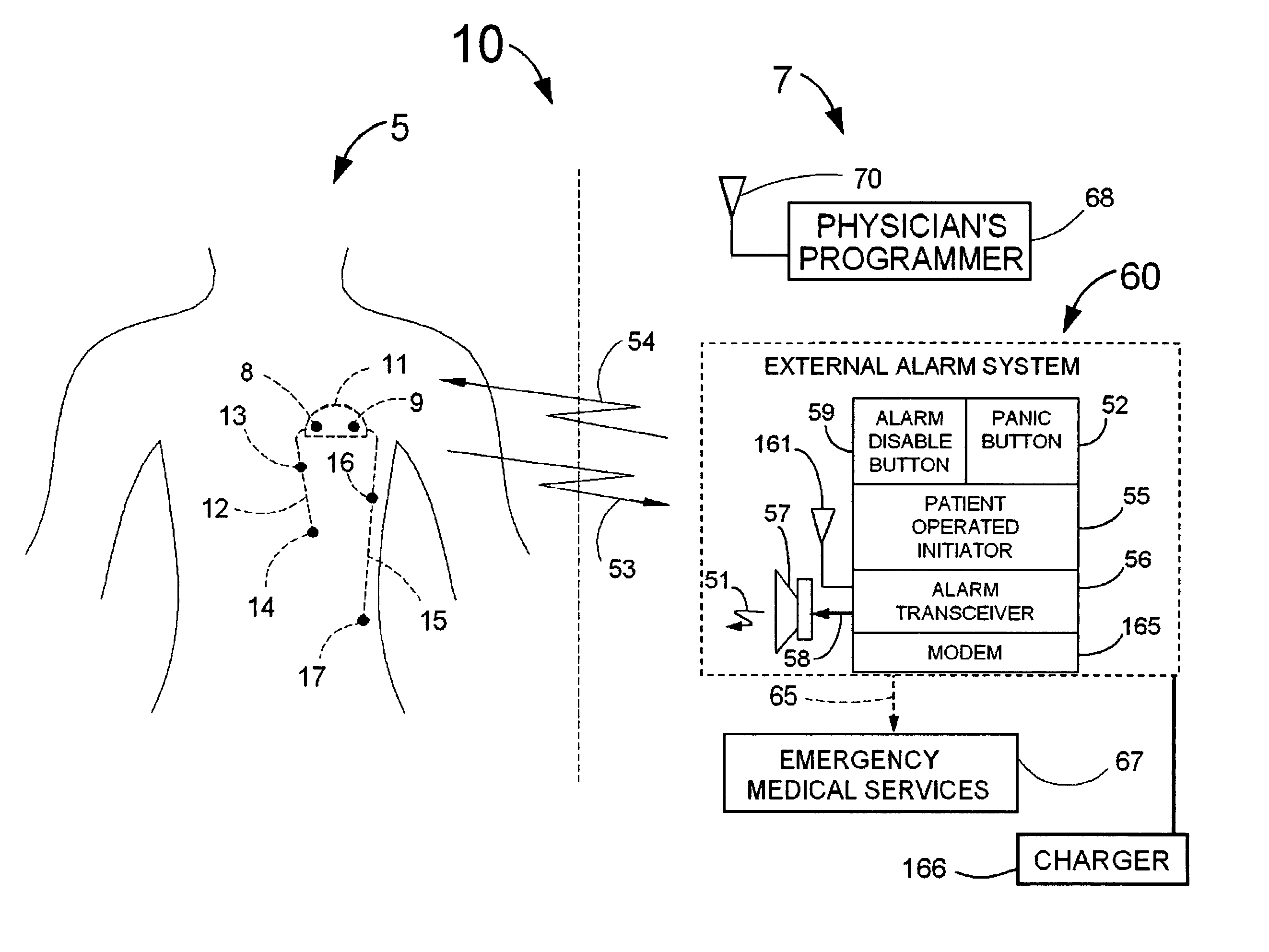 System for the detection of cardiac events