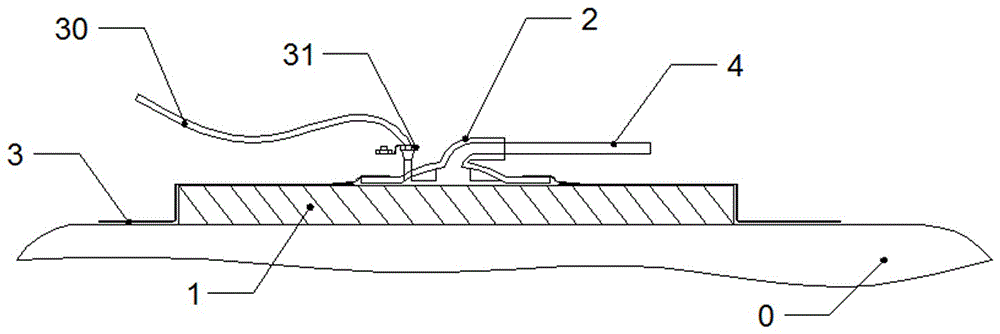 Negative-pressure comprehensive therapeutic device for wound surfaces