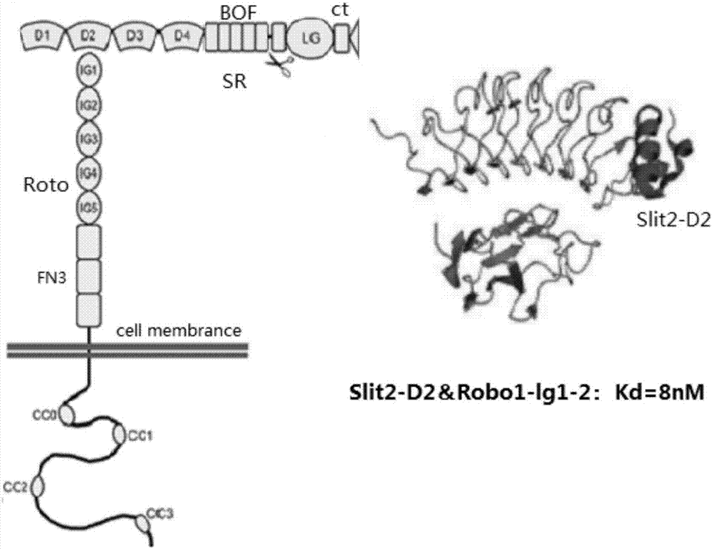 Slit2D2-chimeric antigen receptor and application thereof