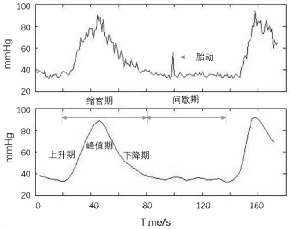 Intelligent oxytocin dosage regulation and control method and system based on uterine contraction signals and LightGBM