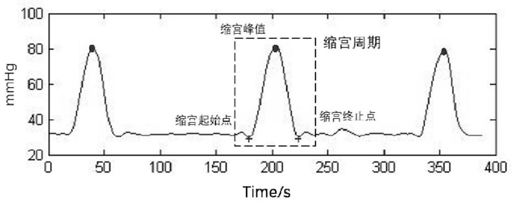 Intelligent oxytocin dosage regulation and control method and system based on uterine contraction signals and LightGBM