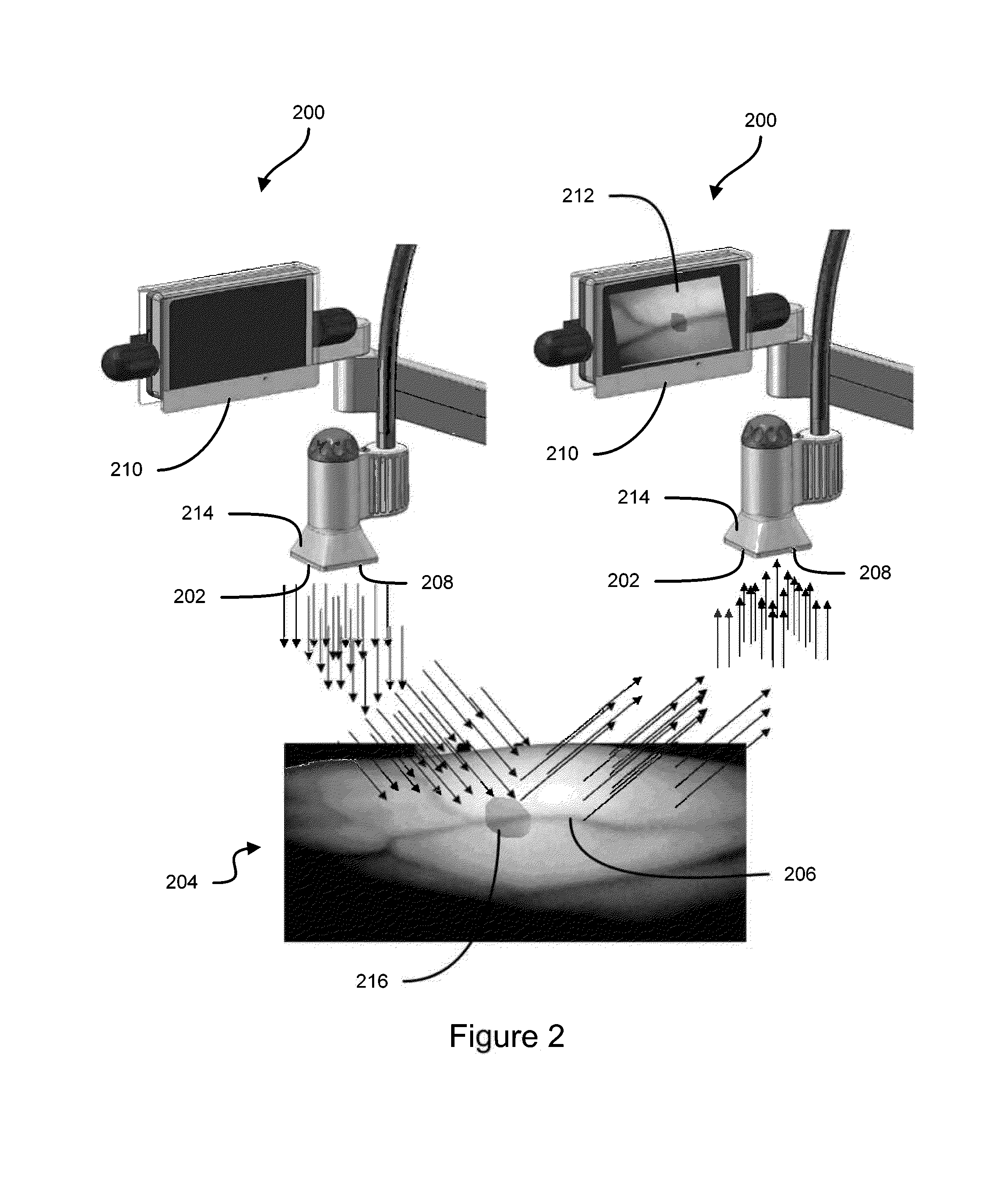 Vein imaging systems and methods