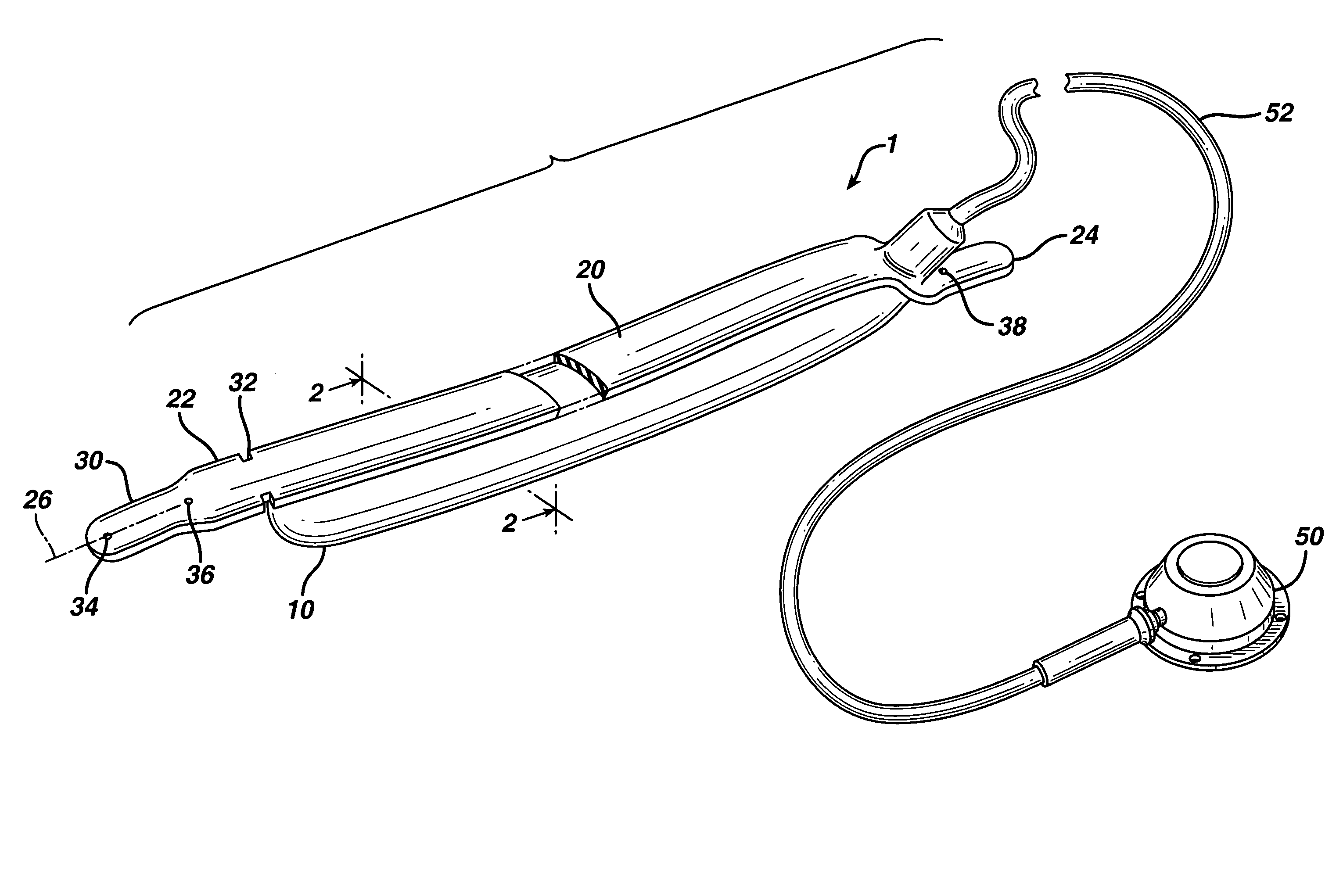 Method for implanting an adjustable band