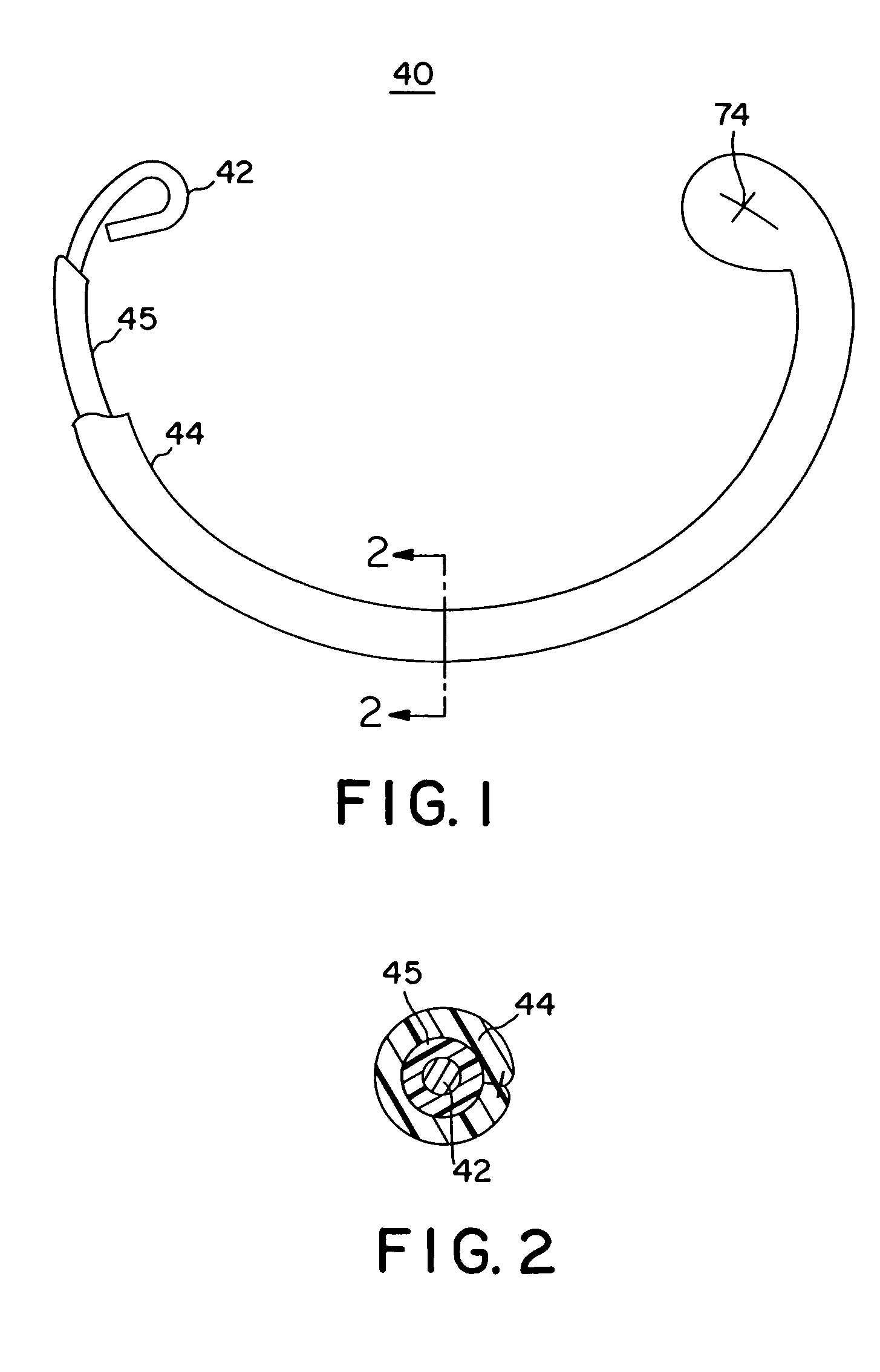 Implantable prosthesis