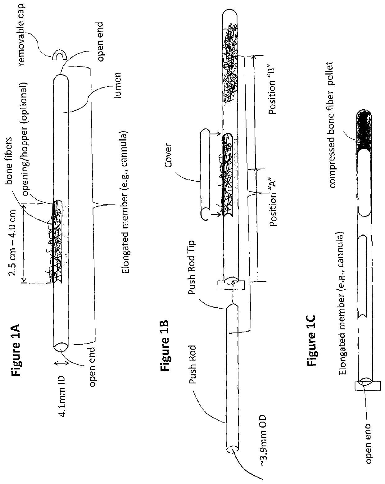 Demineralized bone fiber composition for use in minimally invasive surgery