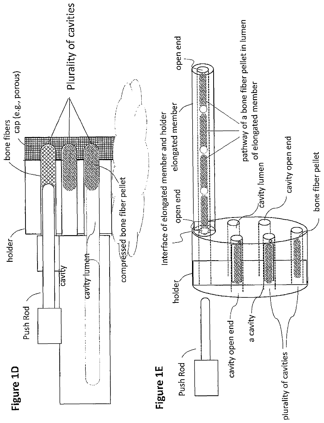 Demineralized bone fiber composition for use in minimally invasive surgery