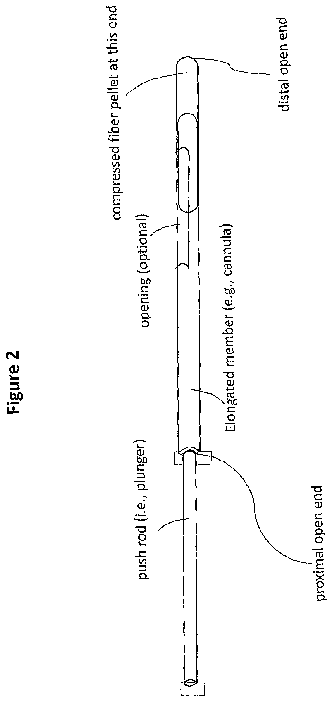 Demineralized bone fiber composition for use in minimally invasive surgery