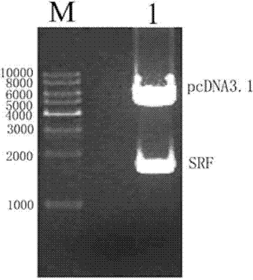 Method for inducing human mesenchymal stem cells to differentiate into insulin-secreting cells in vitro