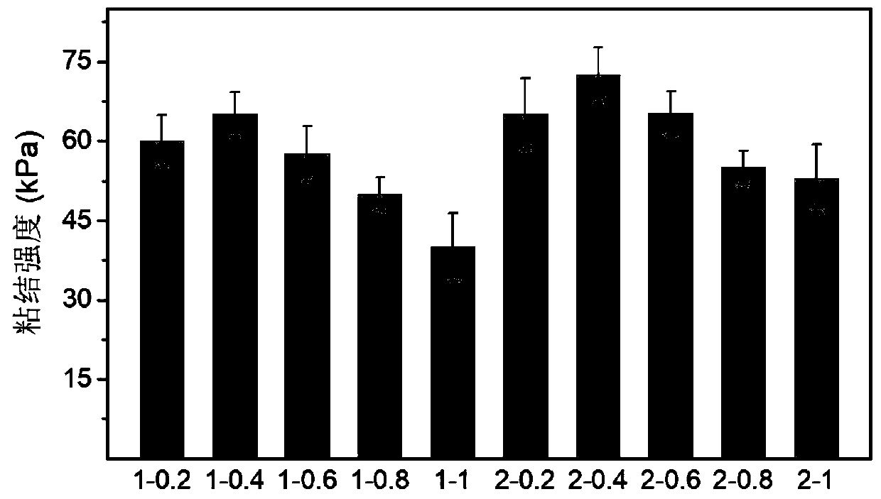 Preparation method of medical adhesive