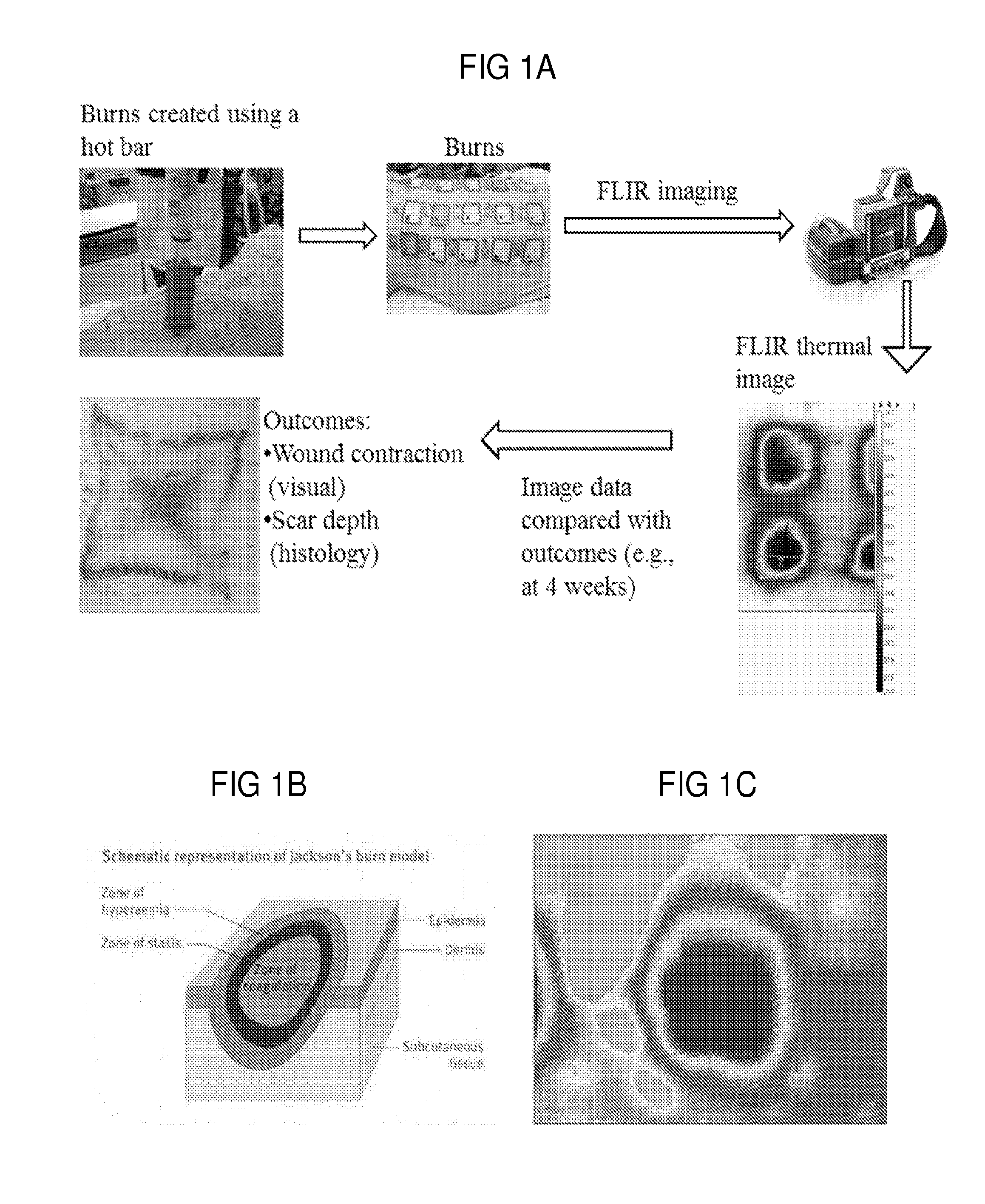 Methods for evaluating tissue injuries