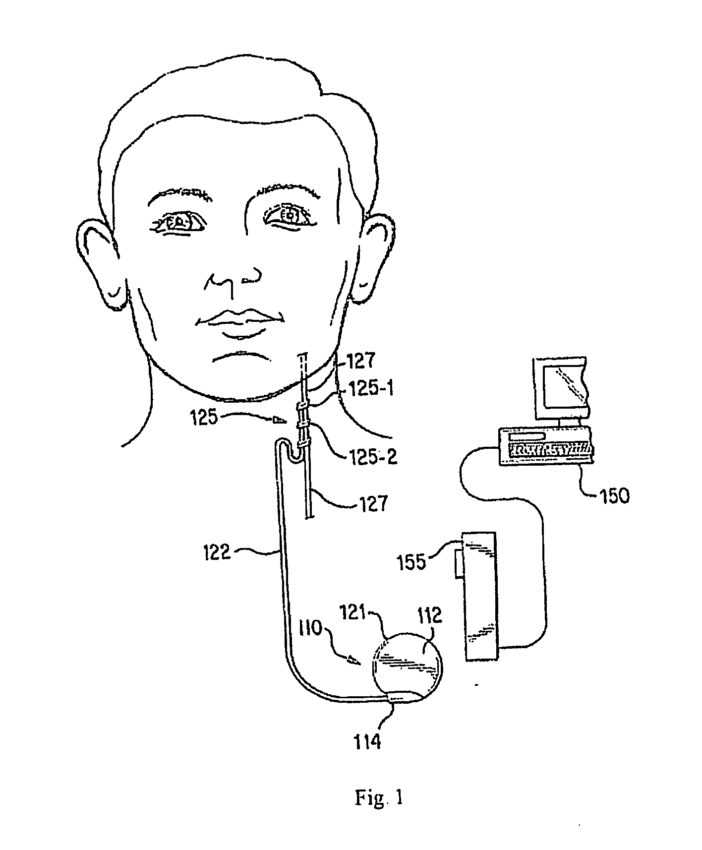 Power supply monitoring for an implantable device