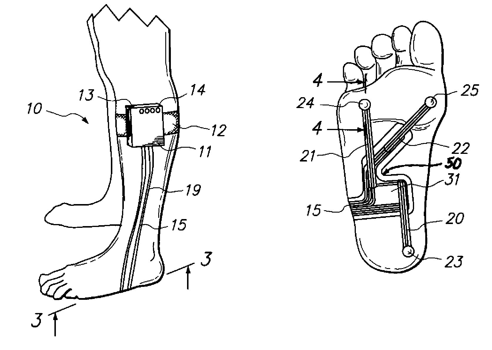 Sensor and analyzer for determining physiological limitations