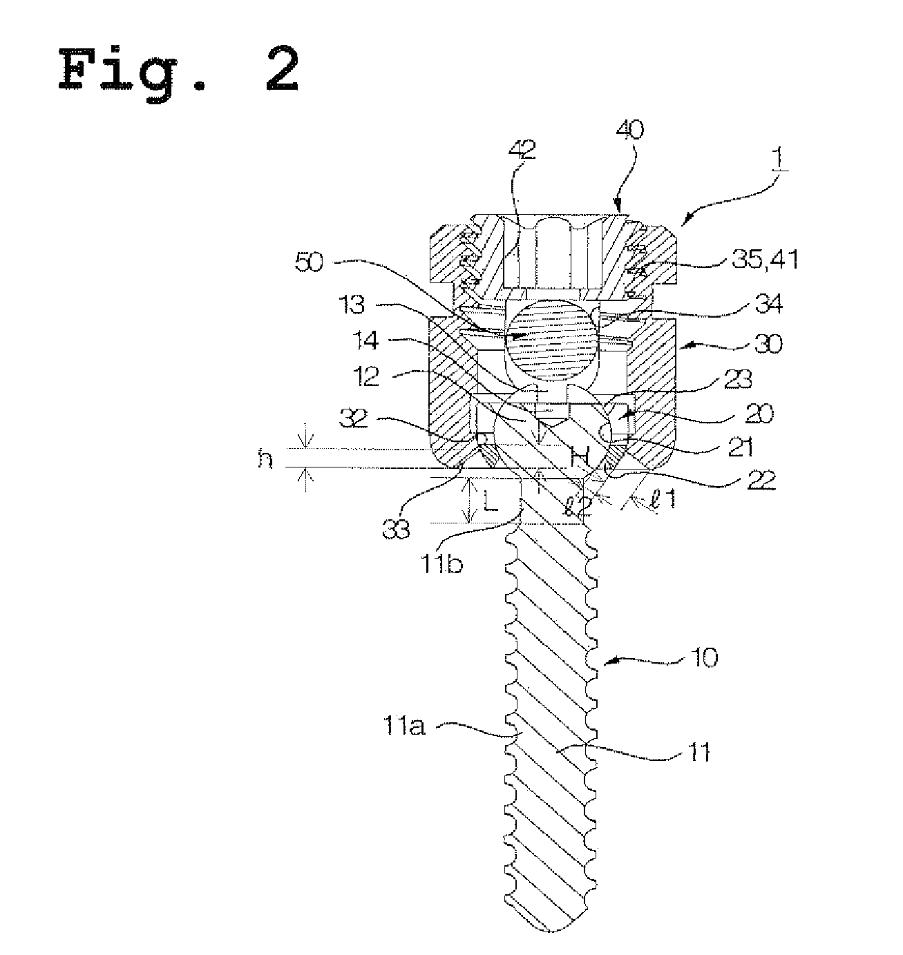 Screw for fixing vertebra