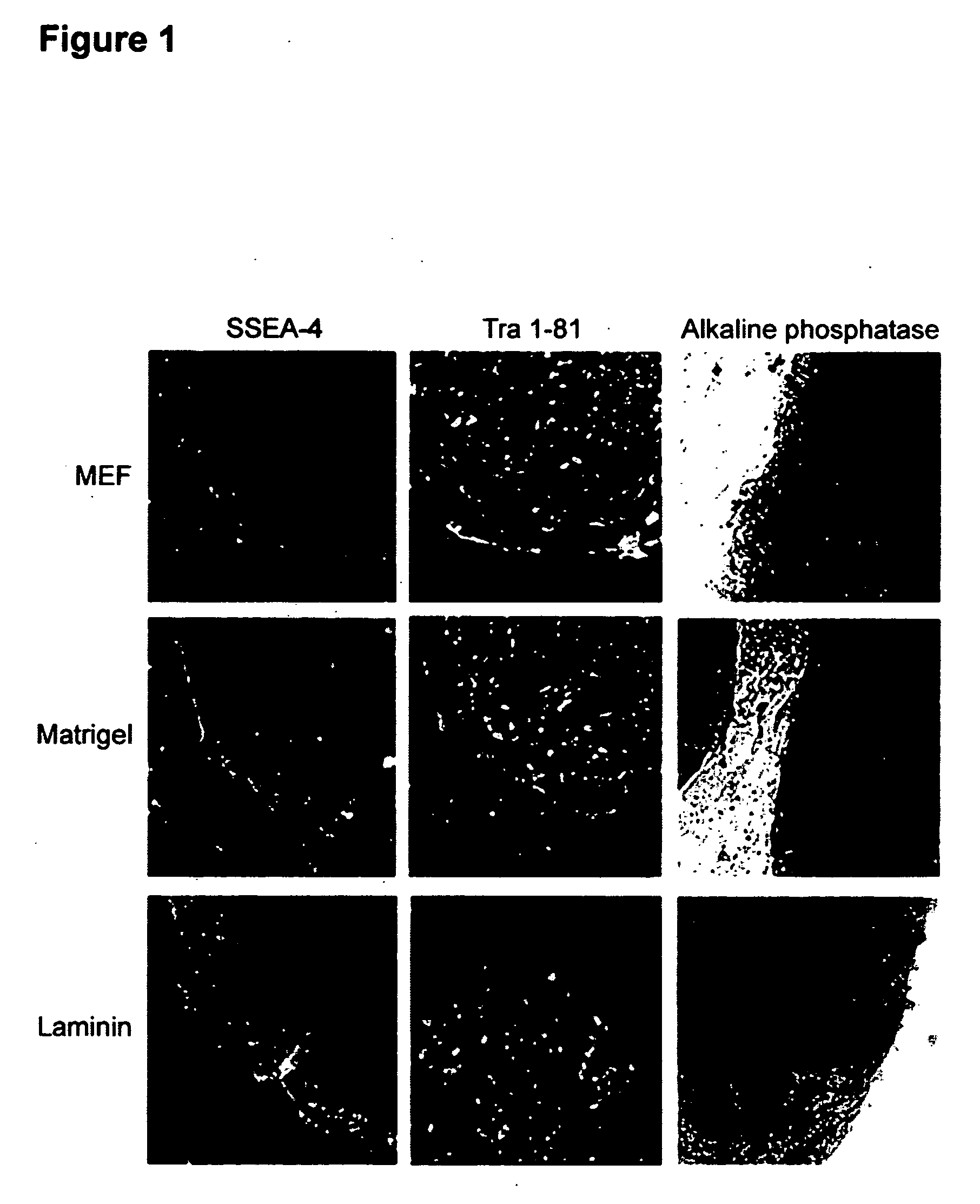 Process for making transplantable cardiomyocytes from human embryonic stem cells