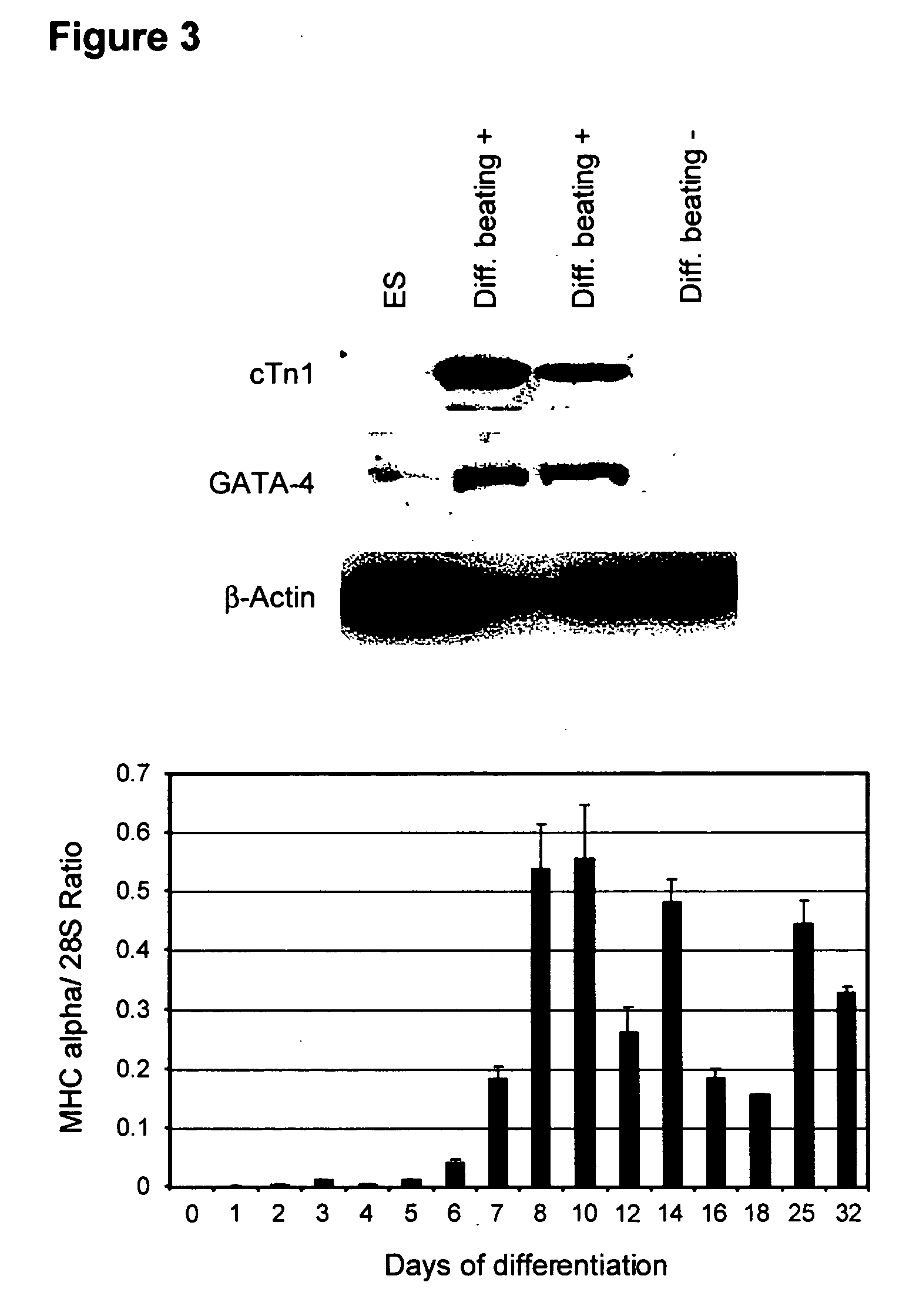 Process for making transplantable cardiomyocytes from human embryonic stem cells