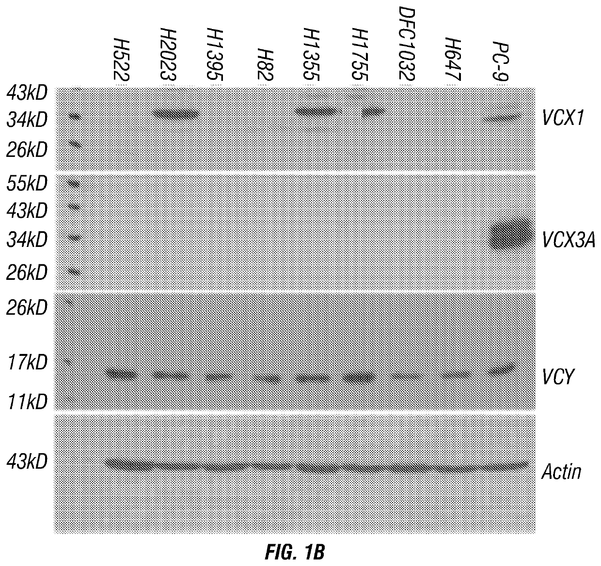 Hla-restricted vcx/y peptides and t cell receptors and use thereof