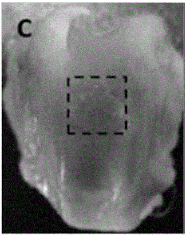 Collagen matrix cartilage repairing membrane, and making method and application thereof