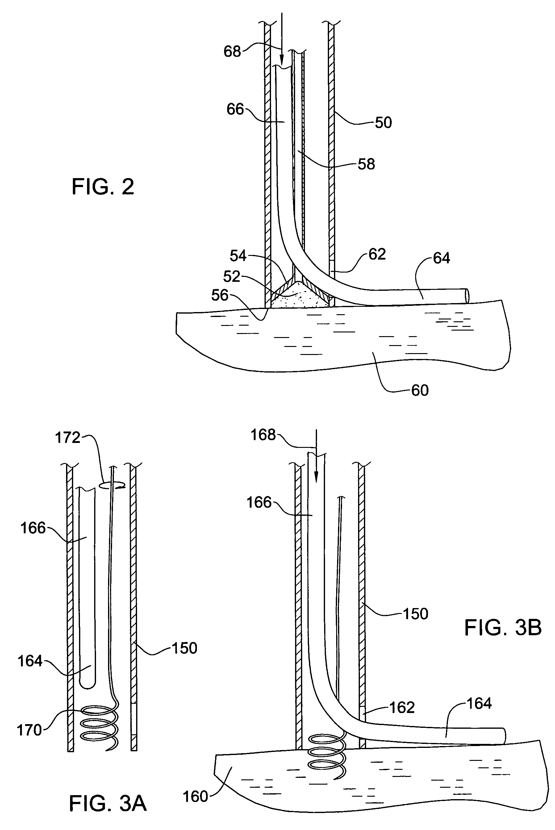 Catheter for delivering a tissue ablation probe