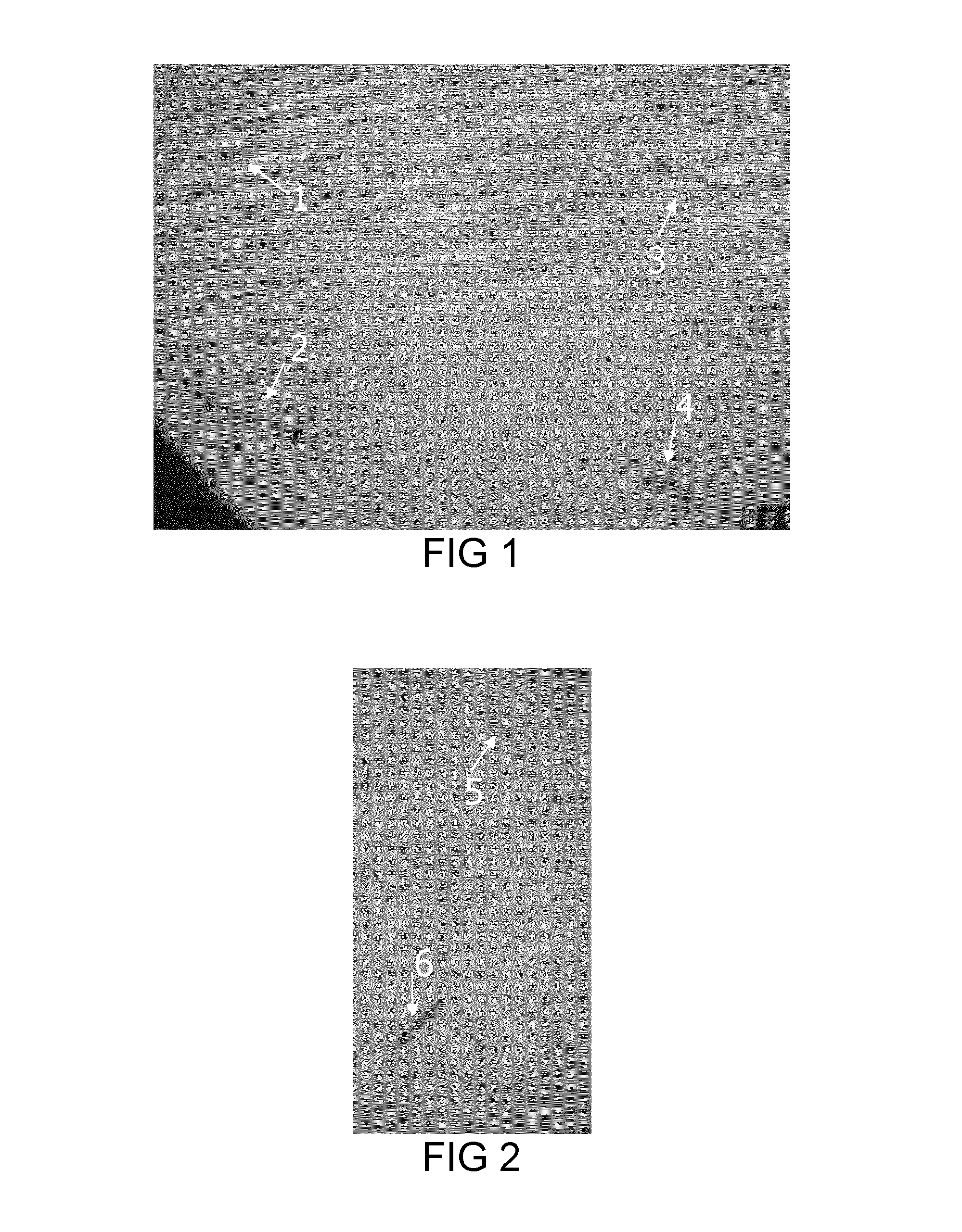 Implant having a core and a tube encasing the core