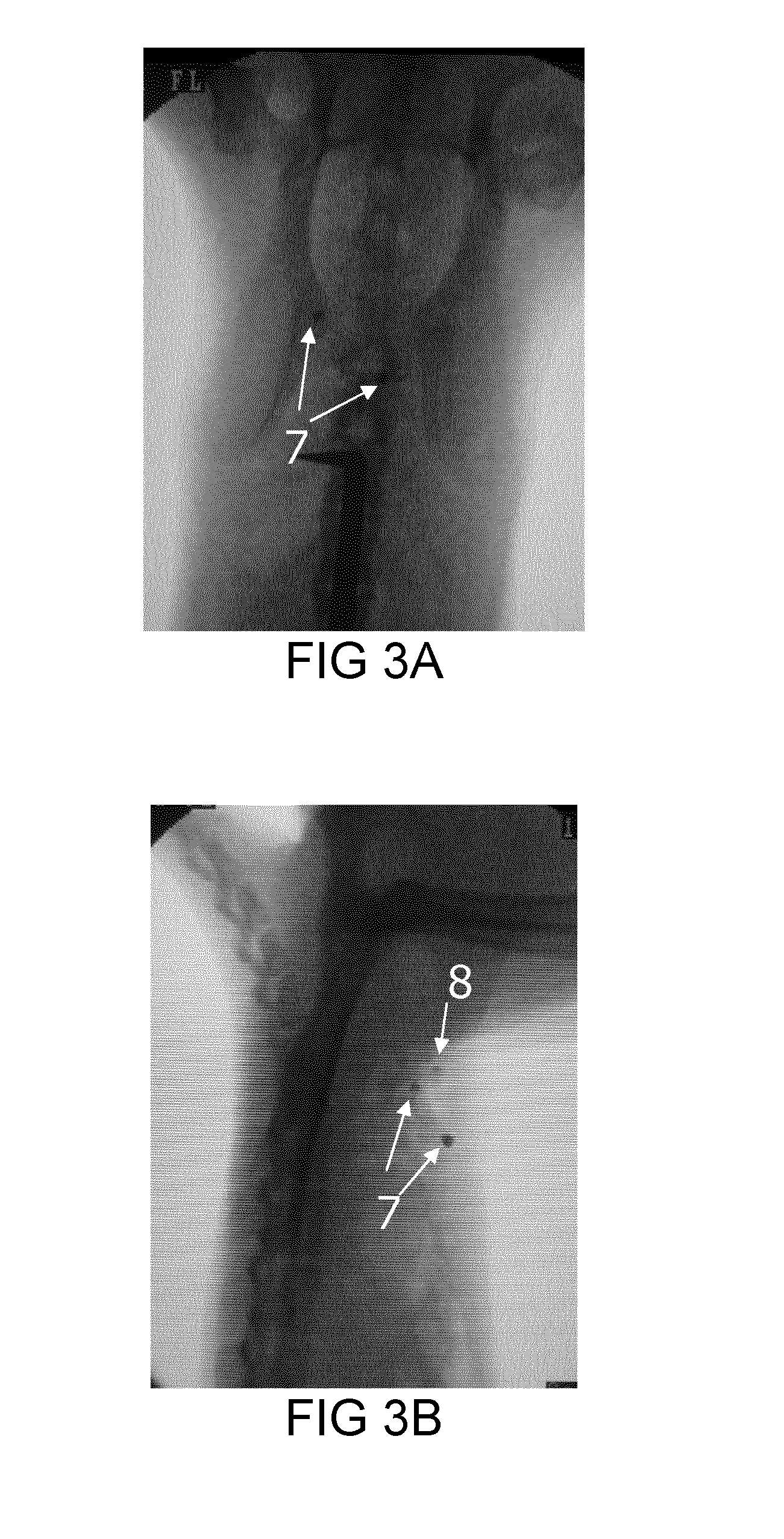 Implant having a core and a tube encasing the core