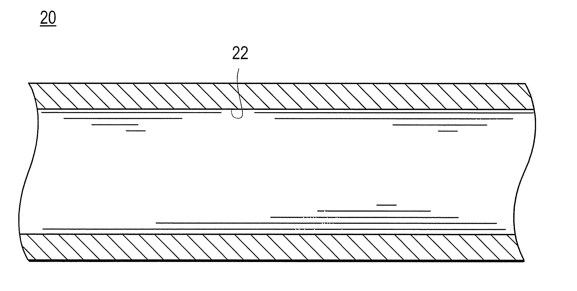 Medical elongate member, method of manufacturing the same, and apparatus for manufacturing the same