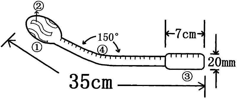 Sigmoid colon expanding bar