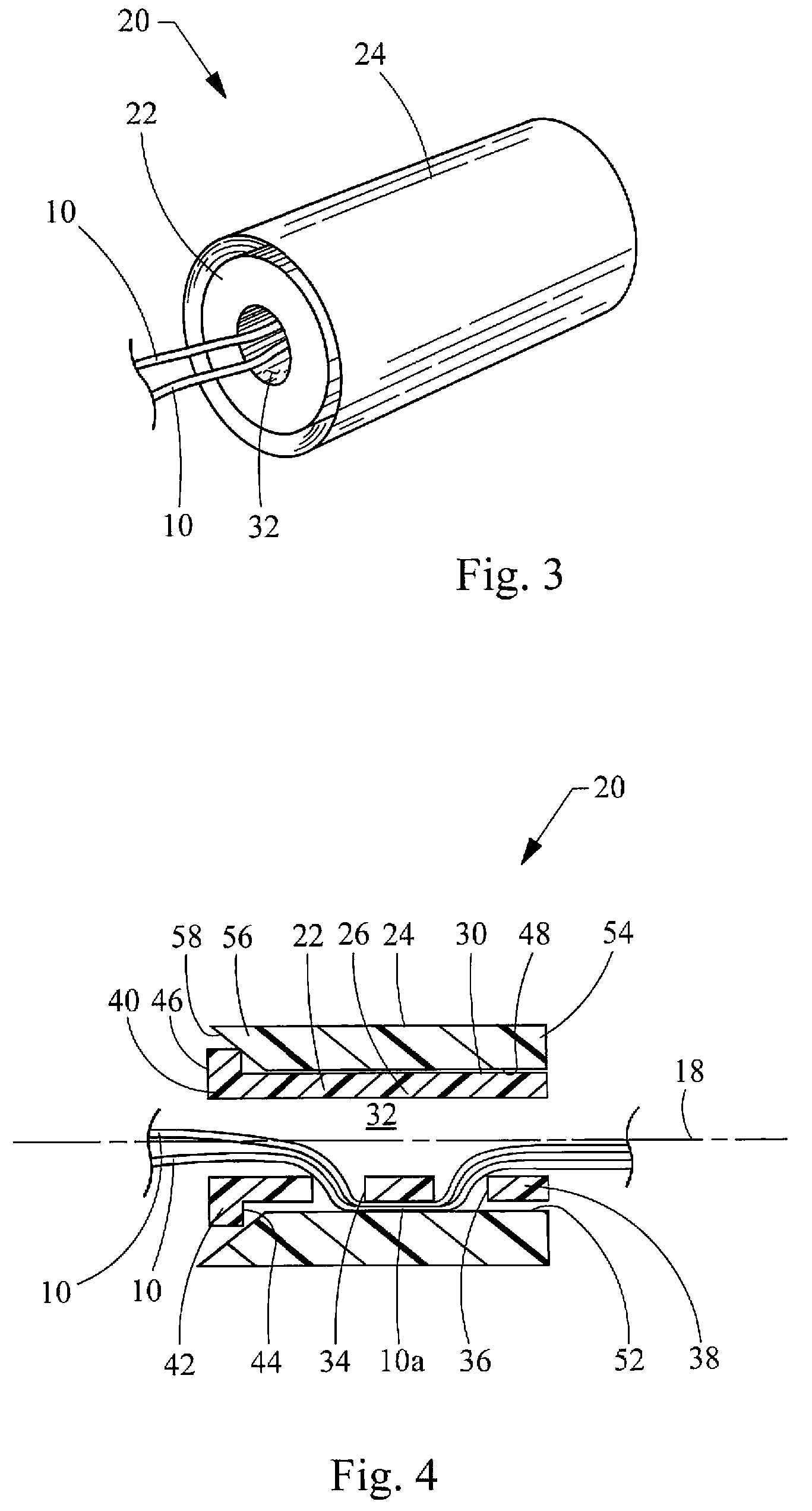 Suture lock