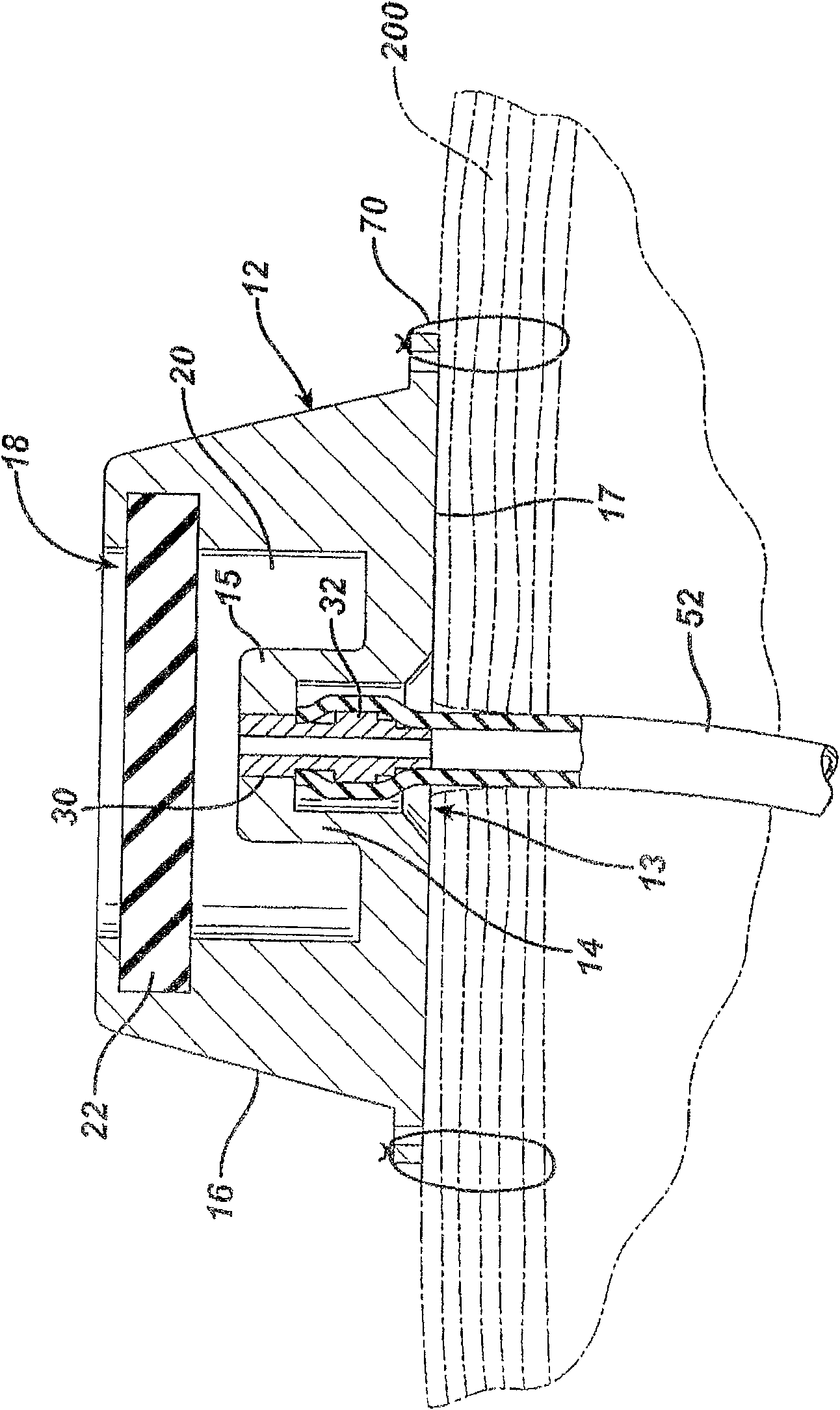 A surgically implantable injection port having a centered catheter connection tube