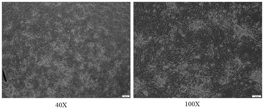 Serum-free medium and preparation method thereof