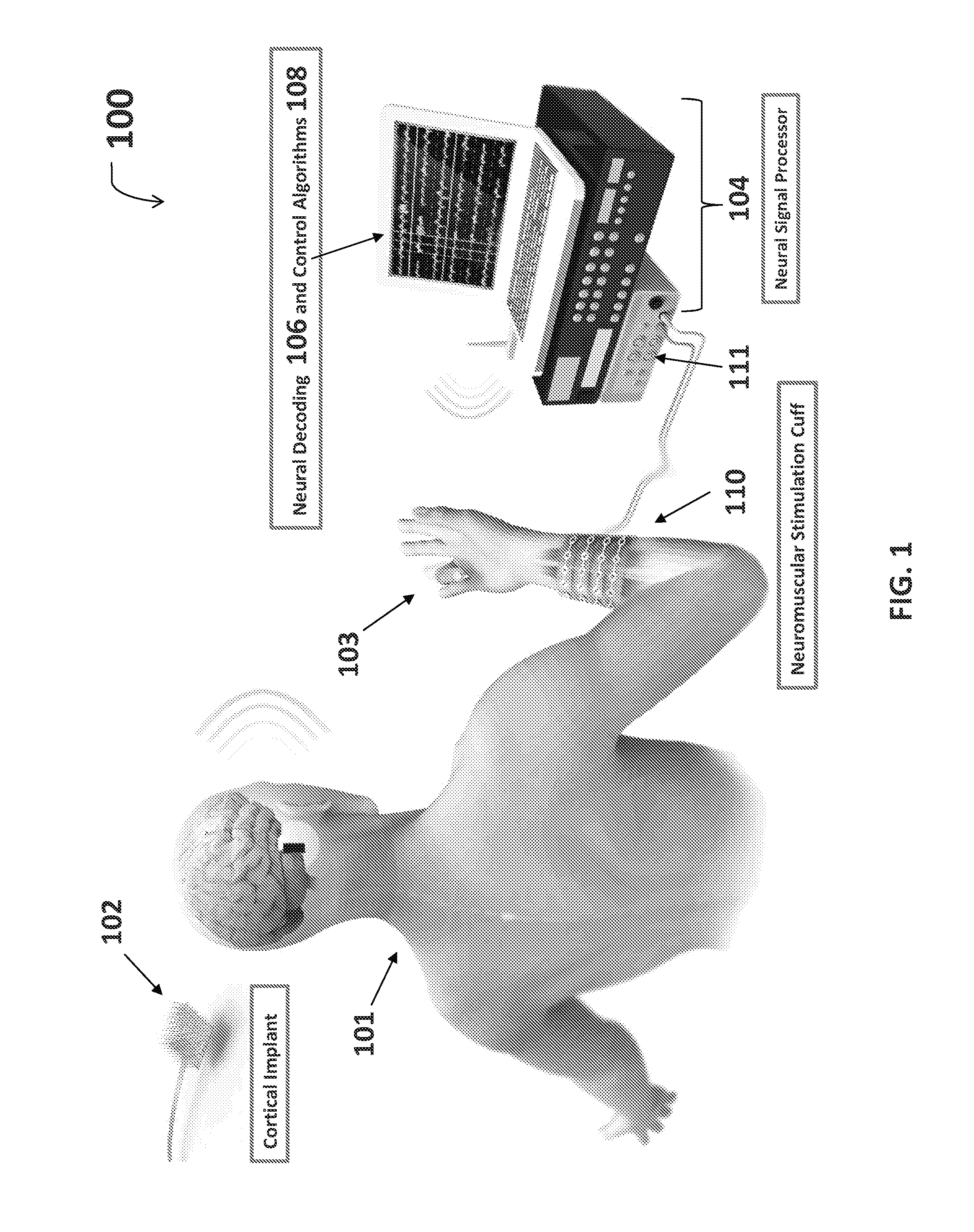 Neuromuscular stimulation cuff