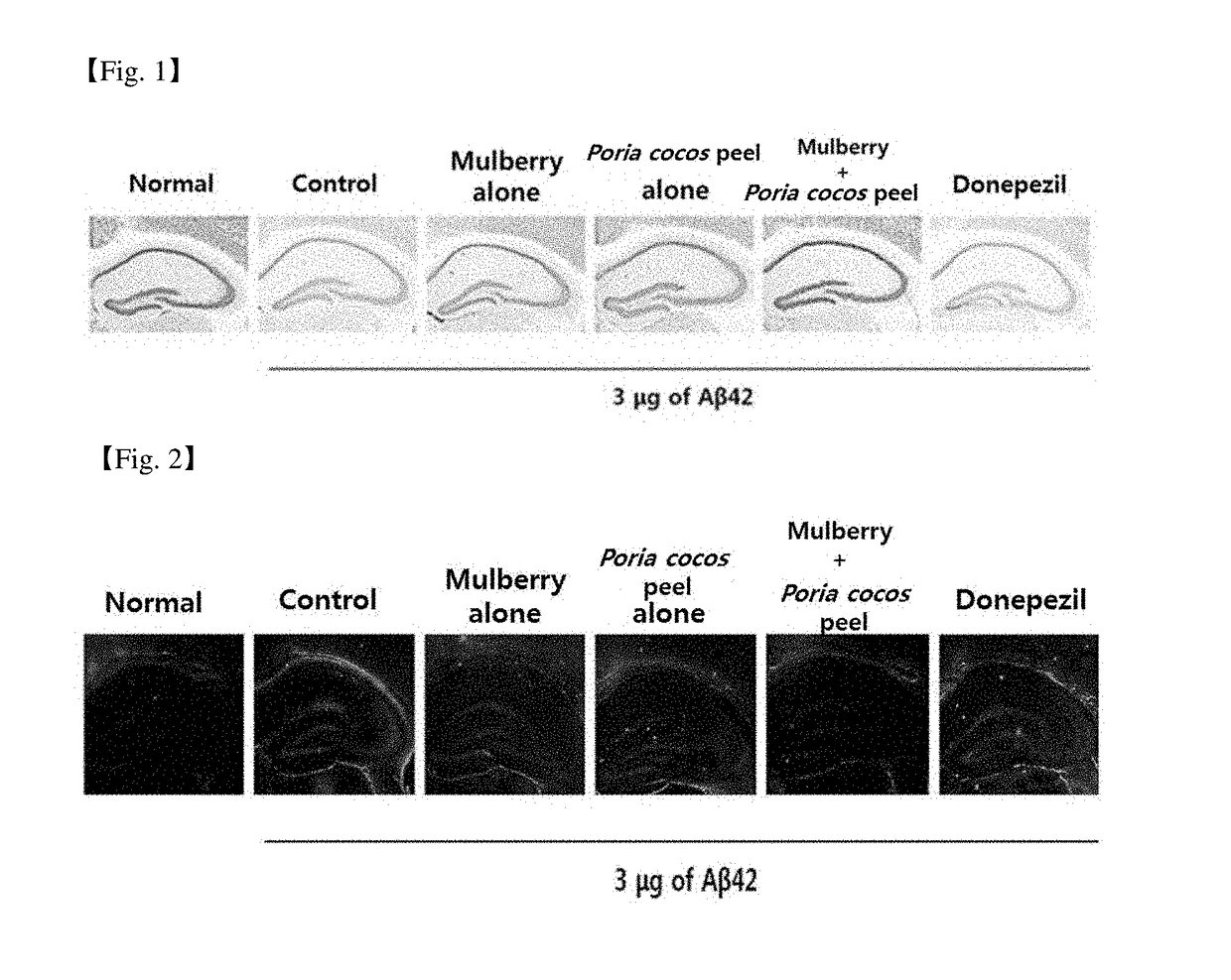 Composition containing mixed extract of mulberry and poria cocos bark for preventing, improving or treating neurodegenerative disorders