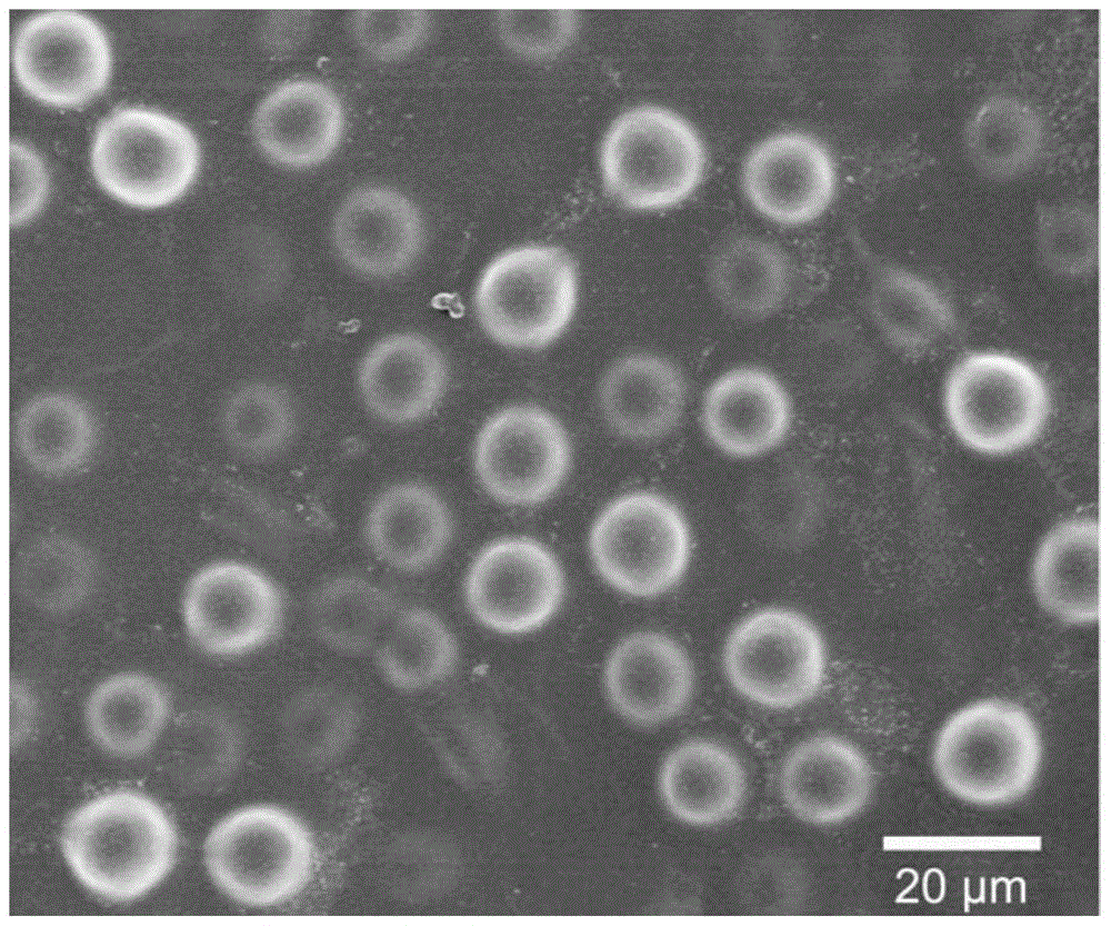 A method for preparing microgel by enzymatic polymerization