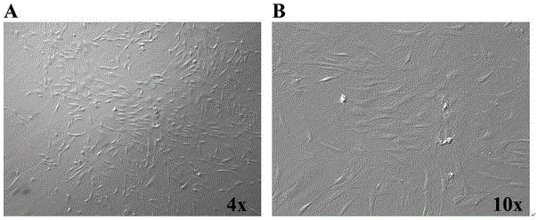 Application of PEDF in preparing medicine for diabetes bone tissue complication