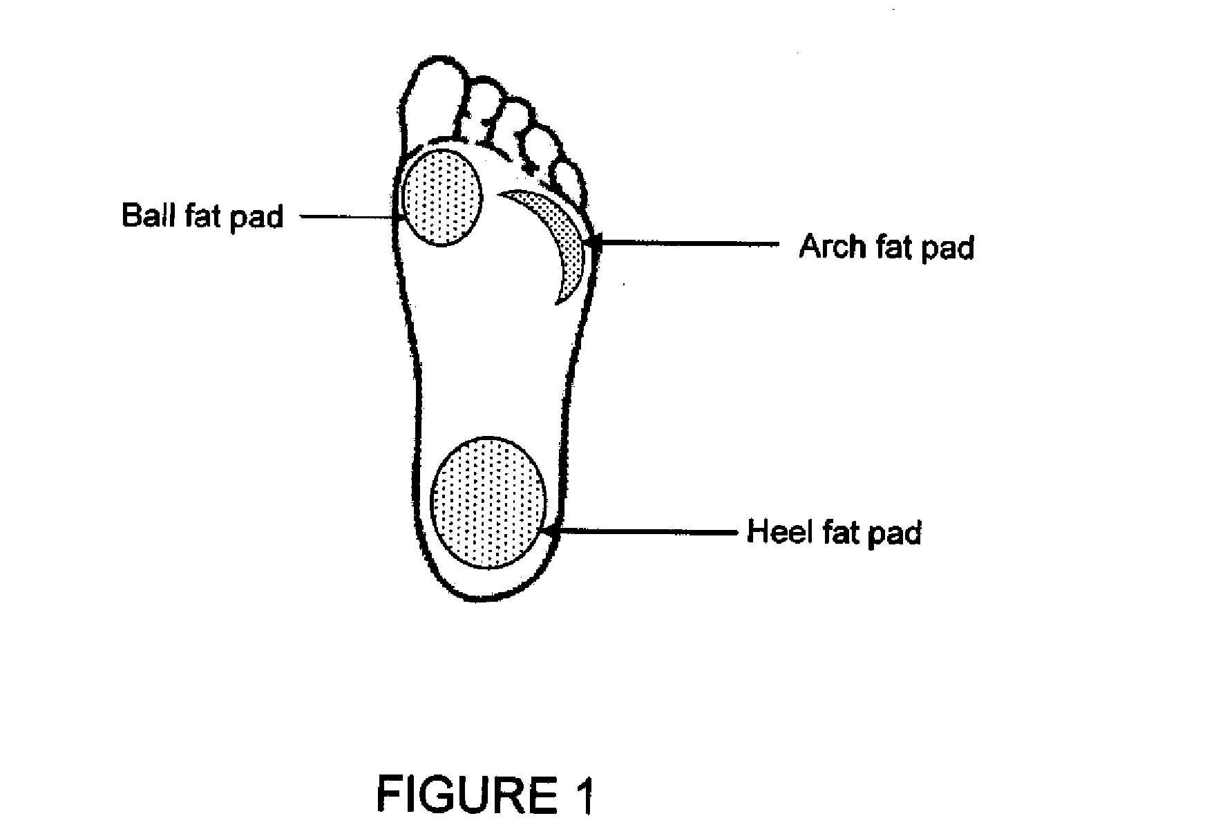 Injectable filler for podiatric and orthopedic uses