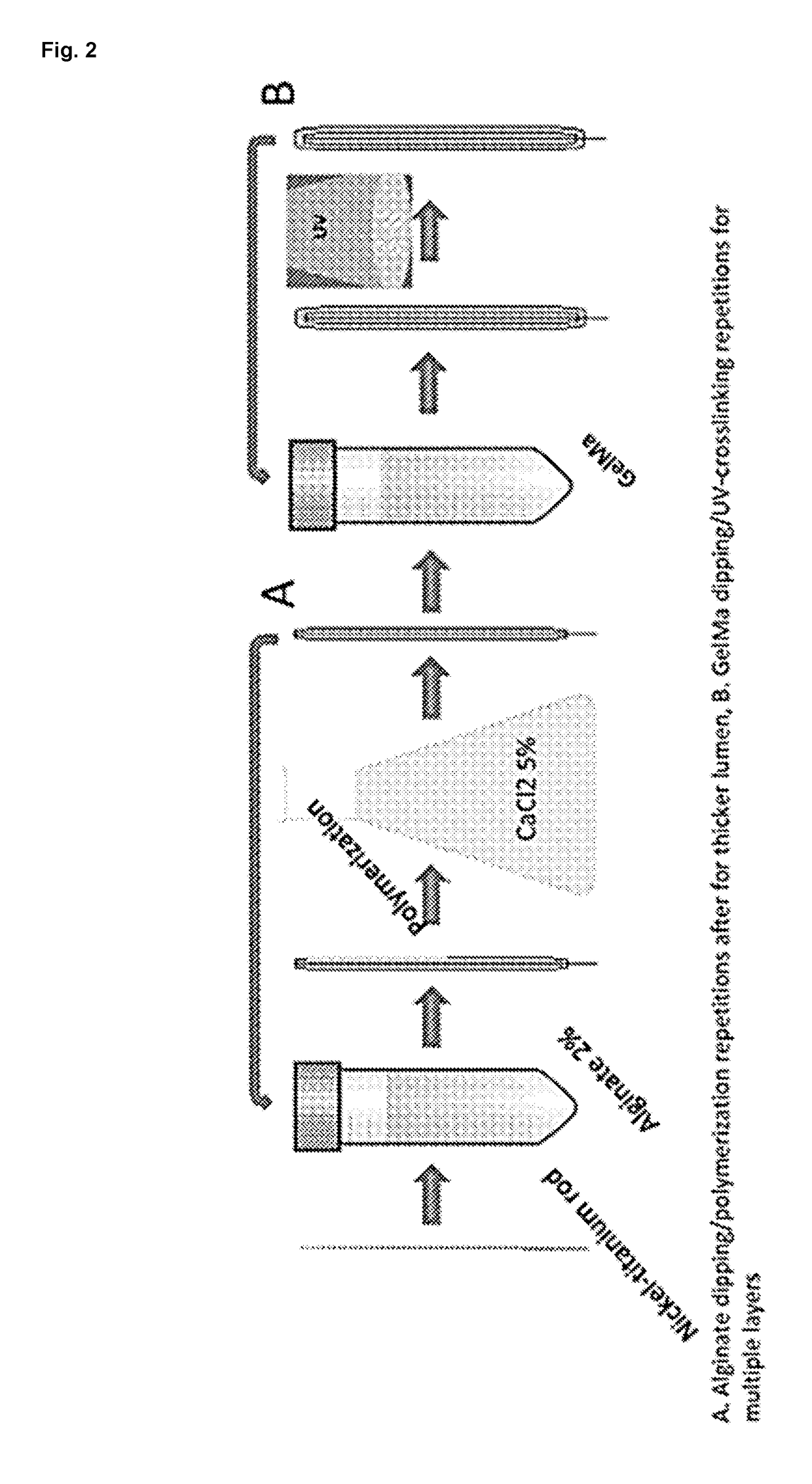 Automated fabrication of layer-by-layer tissue engineered complex tubes