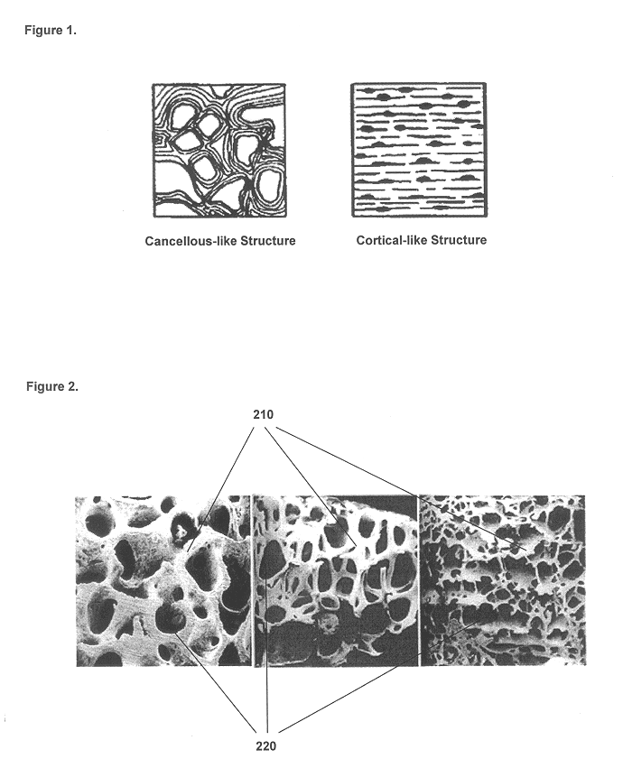 Method for fusing bone during endoscopy procedures