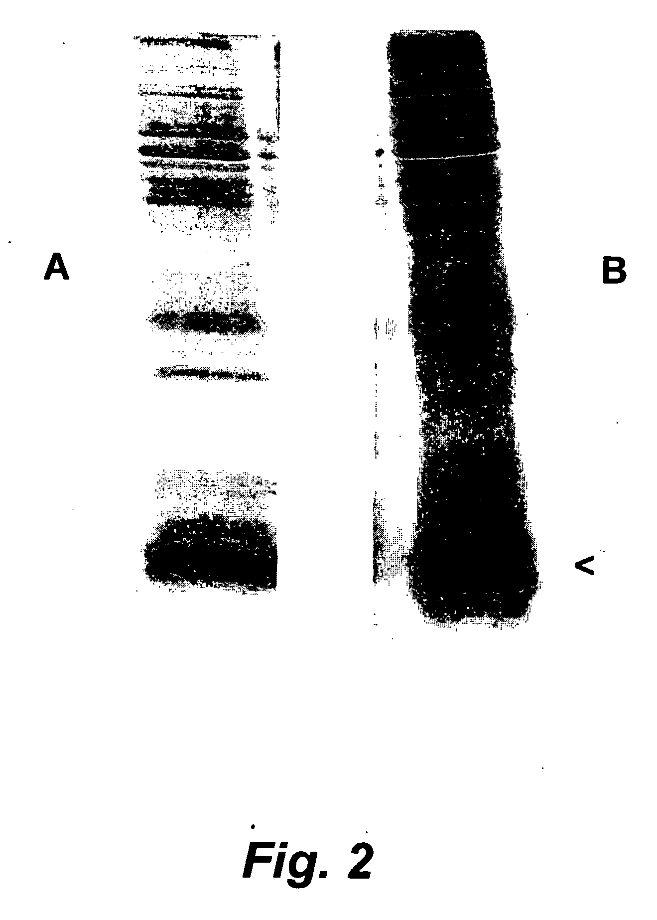 Porcine Helicobacter infection