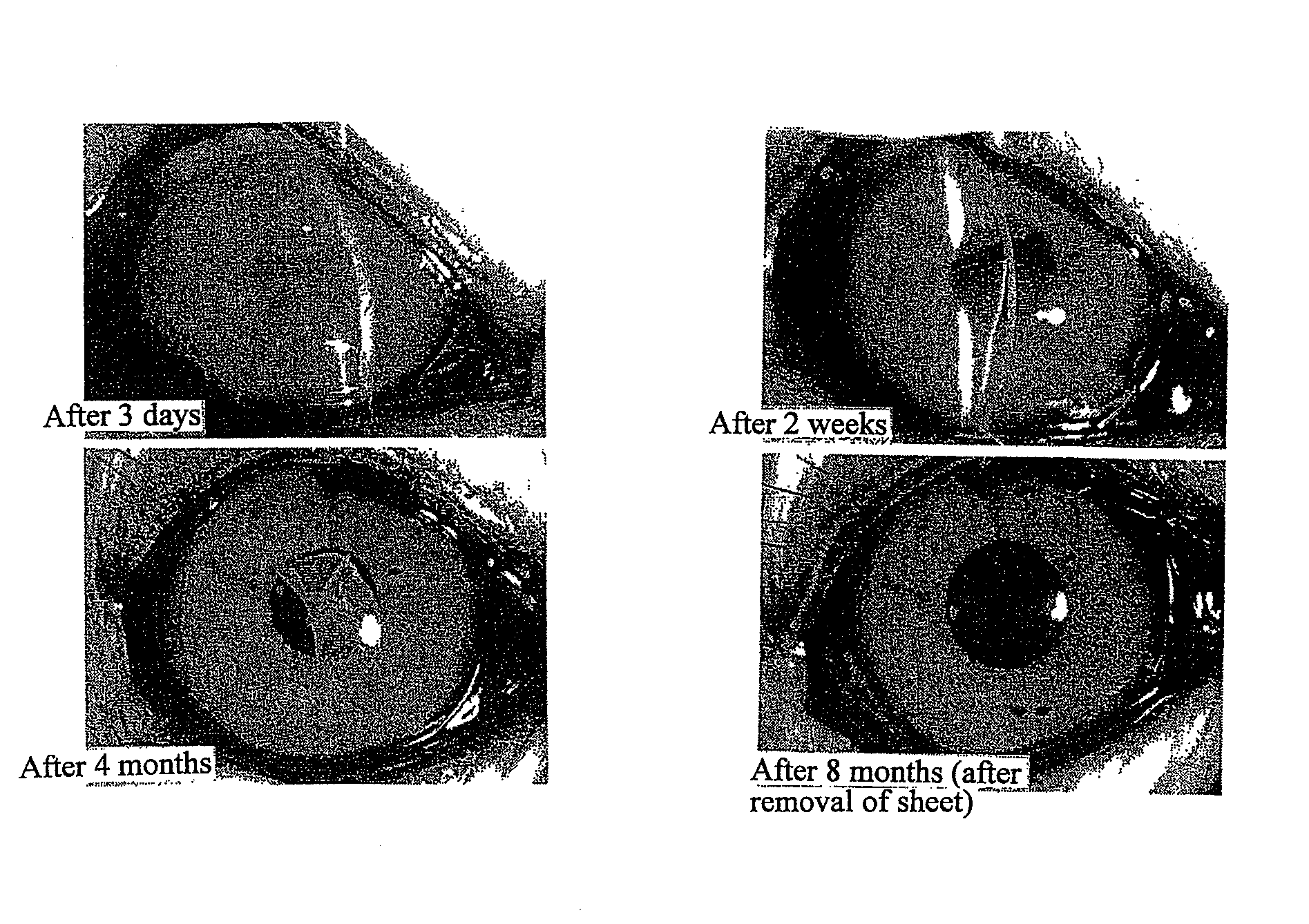 Corneal endothelial preparation which enables cells to grow in vivo