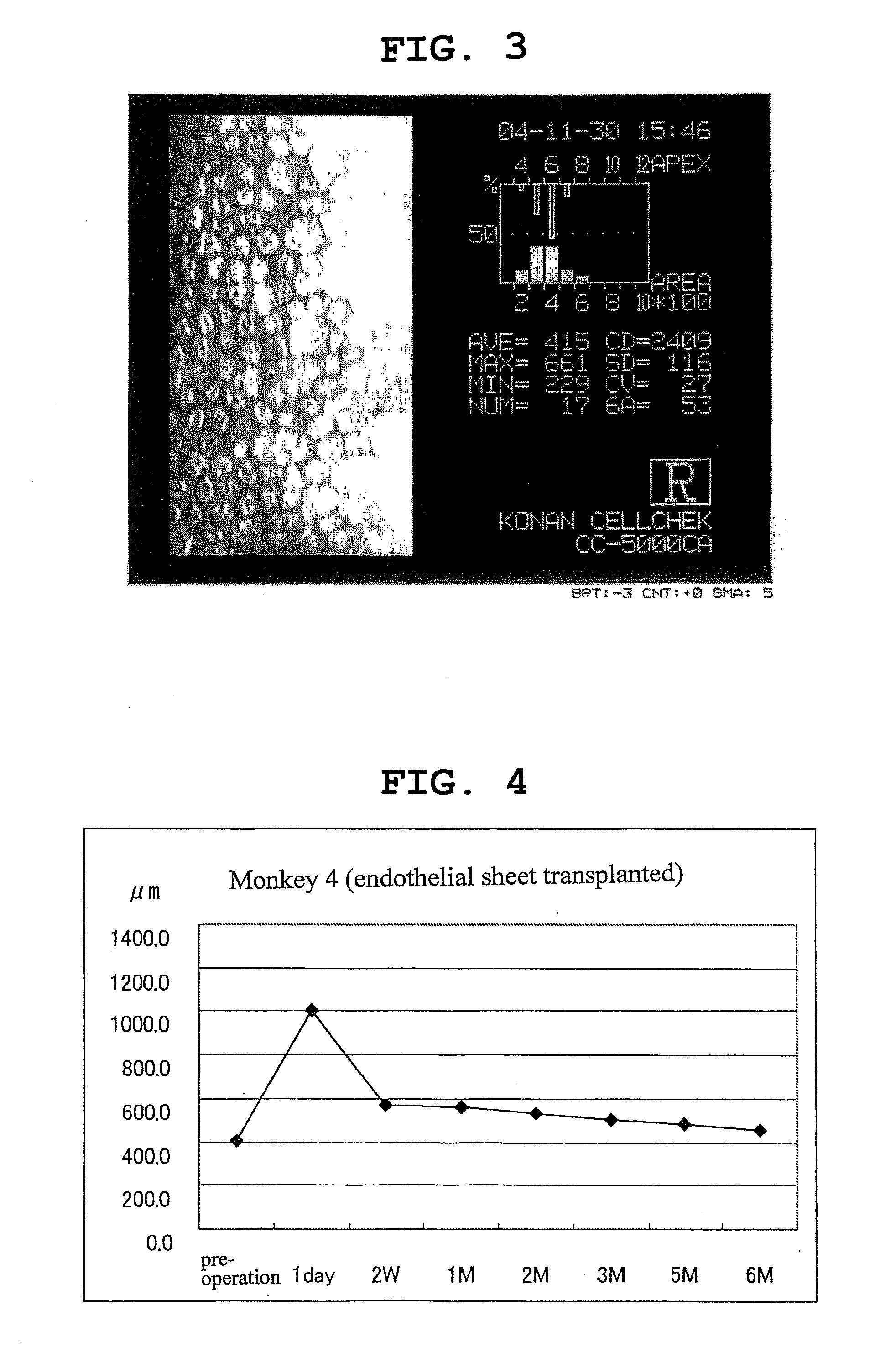 Corneal endothelial preparation which enables cells to grow in vivo